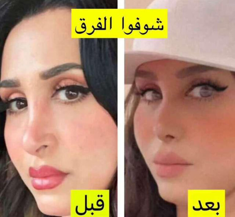 هند القحطاني قبل وبعد التجميل والسفر الى امريكا في 14 صورة