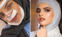 سارة الودعاني قبل وبعد التجميل، غيرت ملامحها وهكذا خسرت وزنها