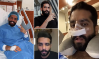 عبدالله الودعاني قبل وبعد التجميل في 20 لقطة،غير ملامحه ورد على تقليد شقيقته