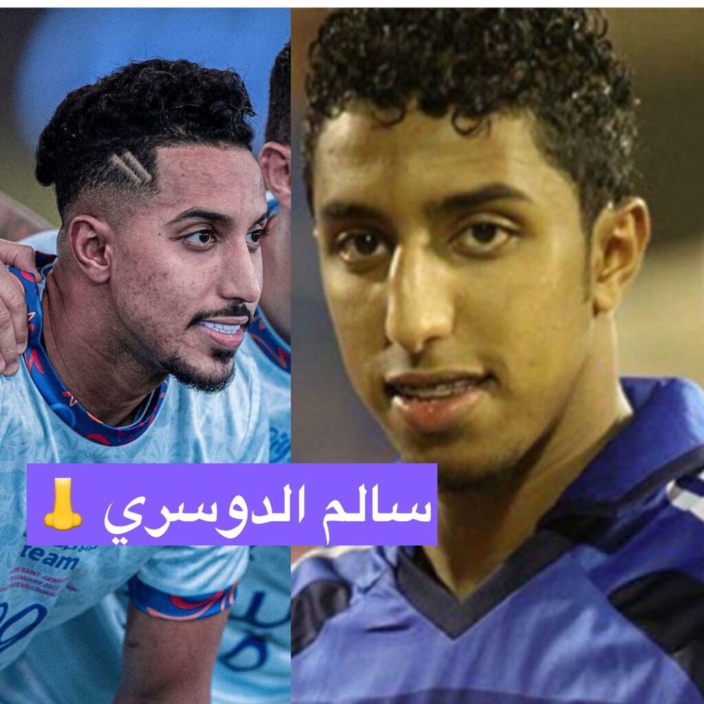 نجم الهلال قبل وبعد التجميل