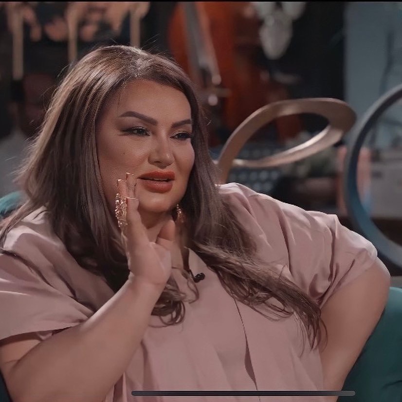 الفنانة الكويتية بملامحها بدون تعديل